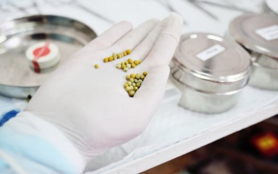 Ăn uống như thế nào để phòng ngừa sỏi mật?