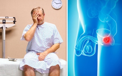 Nên làm gì để giảm nguy cơ mắc ung thư tuyến tiền liệt?