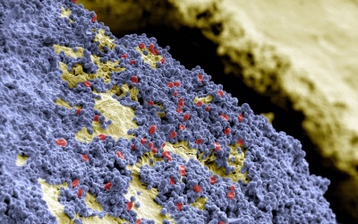 Kinh ngạc với những hình ảnh cận cảnh vi khuẩn bám trên răng của bạn