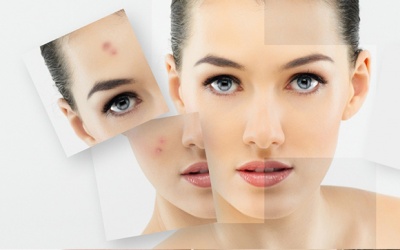 Làm thế nào để nhận biết mụn do rối loạn nội tiết?