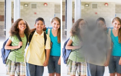 Nguyên nhân nào gây thoái hóa điểm vàng ướt?