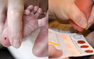 Lấy máu gót chân trẻ sơ sinh có thể giúp phát hiện bệnh gì?