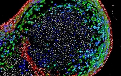 Lần đầu tiên nuôi cấy thành công thực quản người trong phòng thí nghiệm