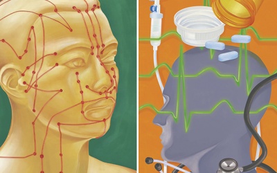 Điều trị mụn nội tiết trên da mặt: Cần kết hợp cả Đông Tây kim cổ