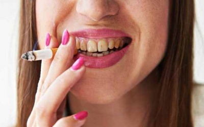 Những 'thủ phạm' khiến răng ố vàng