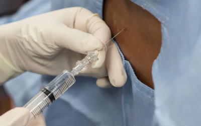 Gây tê tủy sống khi sinh mổ có tác hại gì? 