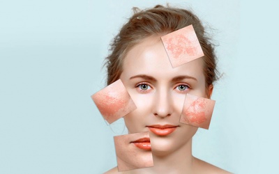 Không biết nguyên tắc trị nám này, dùng mỹ phẩm hàng hiệu cũng không hiệu quả