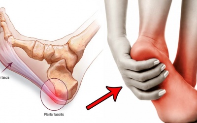 Đau gót bàn chân và gót chân do đâu?