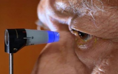 Những cách đơn giản giúp ngăn ngừa bệnh tăng nhãn áp