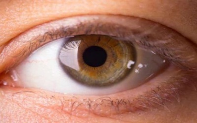 Ăn gì để đôi mắt khỏe mạnh hơn?