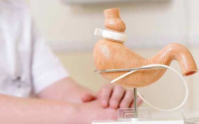 Phẫu thuật giảm cân có thể làm tăng nguy cơ mắc sỏi mật