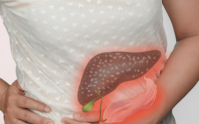 Thiếu muối mật gây sỏi mật, xơ gan: Làm sao để phòng ngừa?