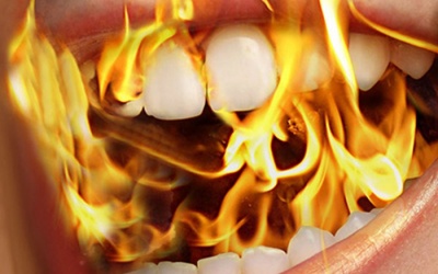 Bị nóng rát miệng, khô miệng có phải do mãn kinh?