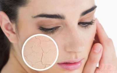 Mùa Đông nên ăn những loại thực phẩm này để tránh khô da!