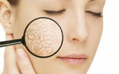 9 thói quen khiến làn da bị khô