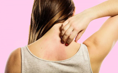 Ngứa da có thể tiết lộ nhiều vấn đề sức khỏe nguy hiểm
