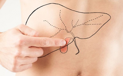 Làm sao để hỗ trợ điều trị, phòng ngừa sỏi mật một cách tự nhiên?