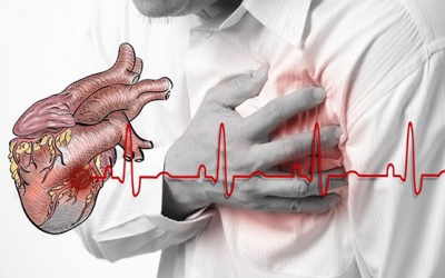 Đau thắt ngực ổn định và không ổn định có gì khác biệt?