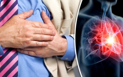 Thiếu máu cơ tim nhẹ, khi nào cần điều trị?