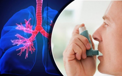 Hen suyễn và viêm phế quản mạn tính khác nhau thế nào? 