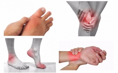 6 dấu hiệu cảnh báo viêm khớp