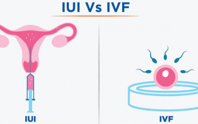 IUI và IVF: Phương pháp điều trị vô sinh nào phù hợp với bạn? 