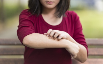 Viêm da tiết bã nhờn nên áp dụng cách này