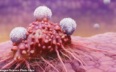 Đột phá: Truyền tế bào miễn dịch vào người bệnh để điều trị ung thư