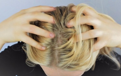 6 cách để kiểm soát gàu theo lời khuyên của chuyên gia