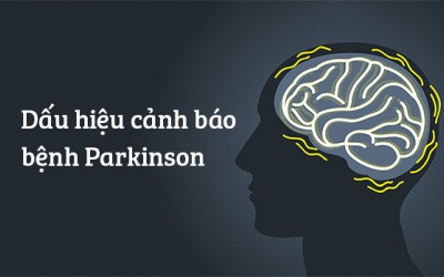 11 dấu hiệu giúp bạn nhận biết sớm bệnh Parkinson