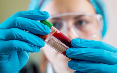 Anh: Xét nghiệm máu mới giúp phát hiện sớm ung thư phổi