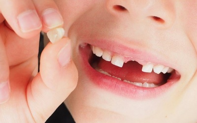 Sốc: Độ mỏng của men răng sữa giúp phát hiện sớm bệnh trầm cảm