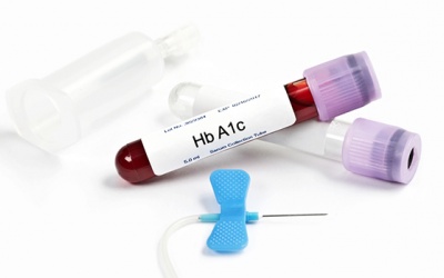 Mọi điều người bệnh đái tháo đường cần biết về xét nghiệm HbA1c