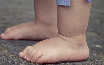 Cha mẹ cần làm gì khi trẻ bị bàn chân phẳng? 