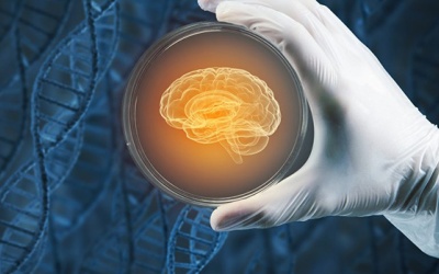 Bệnh Parkinson: Phương pháp tế bào gốc giúp phục hồi tổn thương não bộ