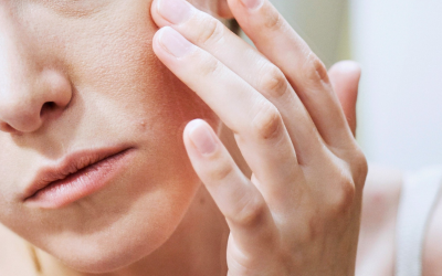 Viêm da cơ địa có nên dùng Eczestop?