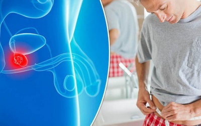 8 thực phẩm giúp làm giảm nguy cơ ung thư tuyến tiền liệt