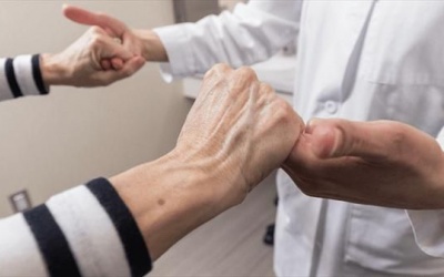 Run tay kèm thoái hóa đốt sống cổ, phải làm gì? 