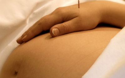 6 lợi ích của châm cứu khi mang thai: Mọi bà bầu nên biết