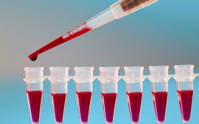 Có phải dùng thuốc chống đông máu cả đời khi bị rung tâm nhĩ? 