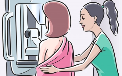 Độ tuổi nào nên chụp nhũ ảnh phát hiện ung thư vú?