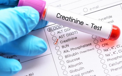 Chỉ số creatinine 162 là suy thận độ mấy? Có cần dùng thuốc?