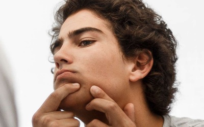 Viêm da tiết bã, mụn nhiều nên ăn uống thế nào?