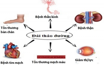 Những biến chứng nguy hiểm chết người của bệnh đái tháo đường 
