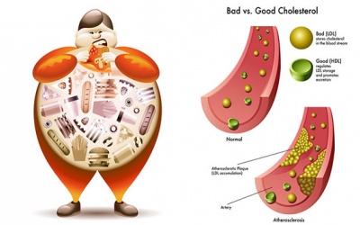 5 biện pháp đơn giản giúp giảm cholesterol mà không cần dùng thuốc