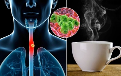 Uống trà nóng có làm tăng nguy cơ ung thư thực quản?