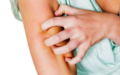 Những biện pháp tự nhiên giúp giảm phát ban nhiệt