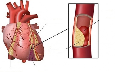 Những cách tự nhiên giúp giảm triglyceride nhanh chóng