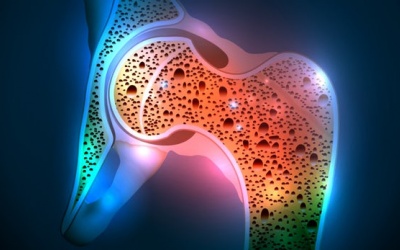 Uống rượu bia và hút thuốc lá gây loãng xương sớm?