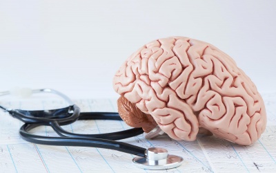 10 điều bác sỹ muốn bạn biết về đột quỵ